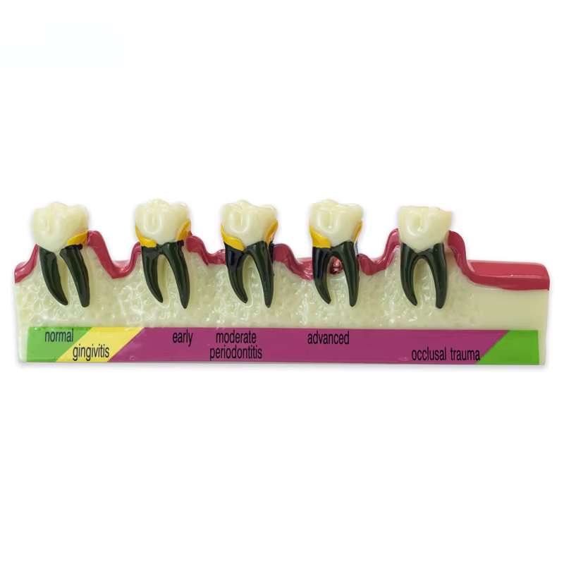 Modèle de dent de maladie dentaire, fuchsia dentaire, dentiste, formation, apprentissage, communicat