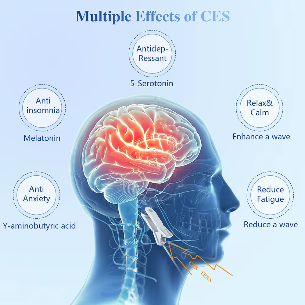 KTS – dispositif d'aide au sommeil, insomnie, anxiété, dépression, thérapie CES, stimulateur transcrânien à microcourant, soulagement de la douleur de la Migraine