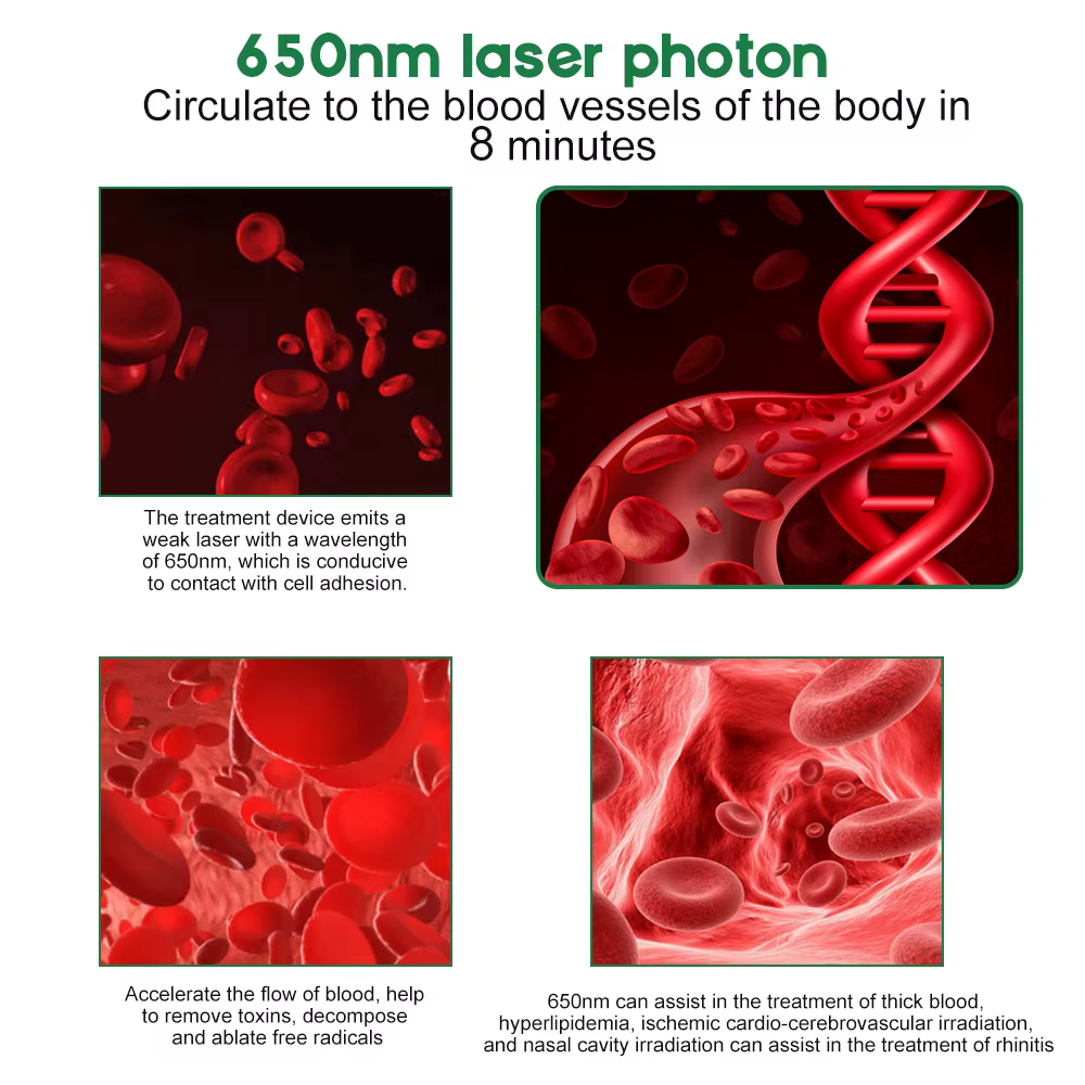 Thérapie au Laser pour acouphènes et oreilles, Irradiation LLLT, otite moyenne, surdité, physiothérapie au Laser, bouchon d'oreille, traitement de la rhinite du nez et de la sinusite
