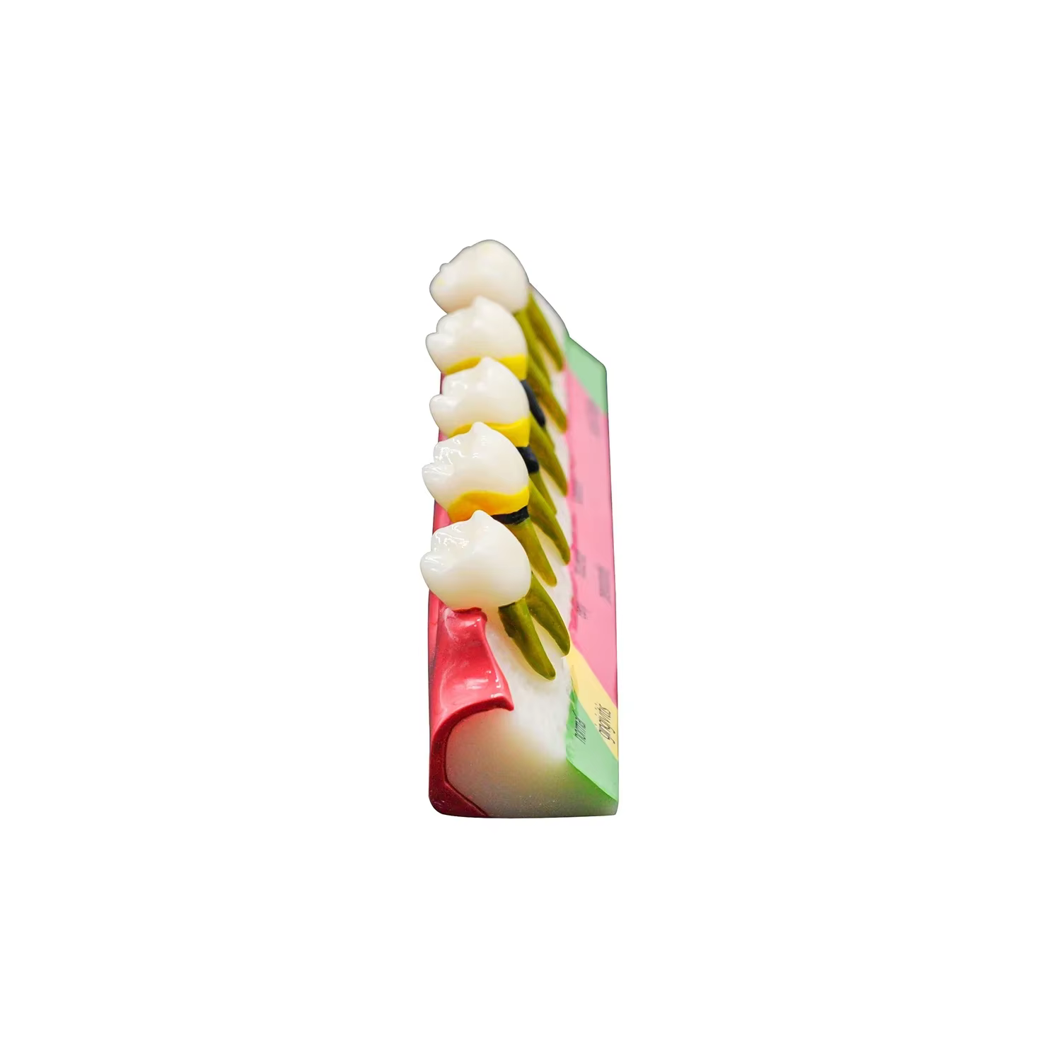 1PC étude dentaire modèle d'enseignement maladies parodontales assortiment dents Dentoform Typodont pour les étudiants dentistes étudiant enseignement