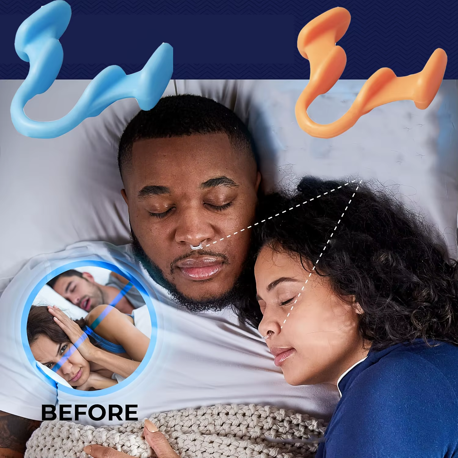 Correcteur anti-ronflement en silicone (2-10 pièces) – Aide au sommeil, dilatateurs nasaux, dispositif anti-ronflement, clip nasal pour améliorer la qualité du sommeil
