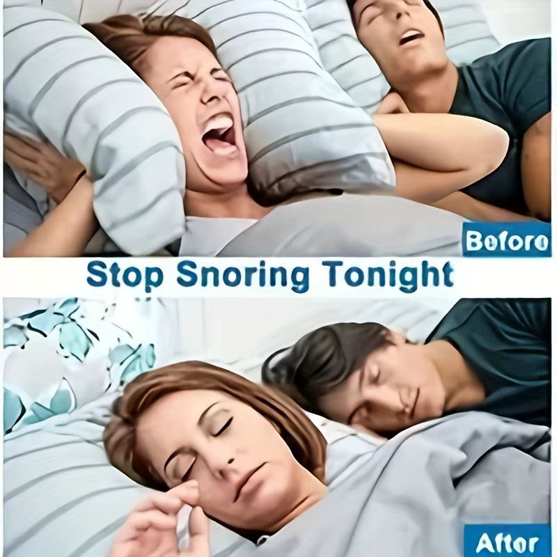 Correcteur anti-ronflement en silicone (2-10 pièces) – Aide au sommeil, dilatateurs nasaux, dispositif anti-ronflement, clip nasal pour améliorer la qualité du sommeil