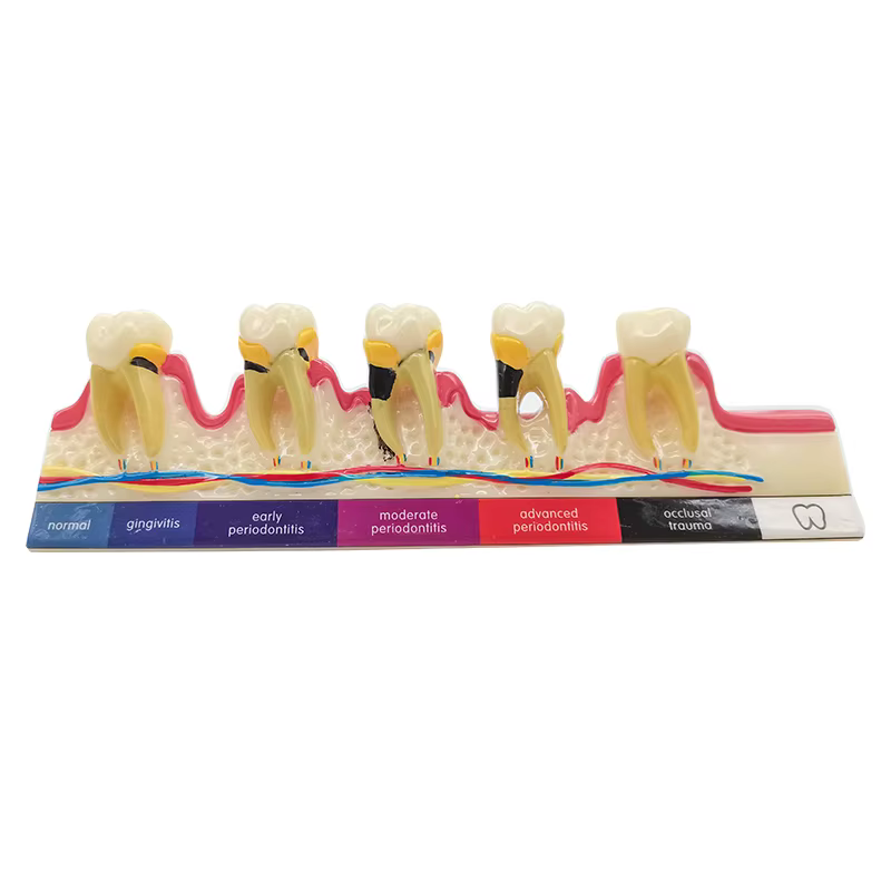 Modèle de dent de maladie dentaire, fuchsia dentaire, dentiste, formation, apprentissage, communication médecin-patient