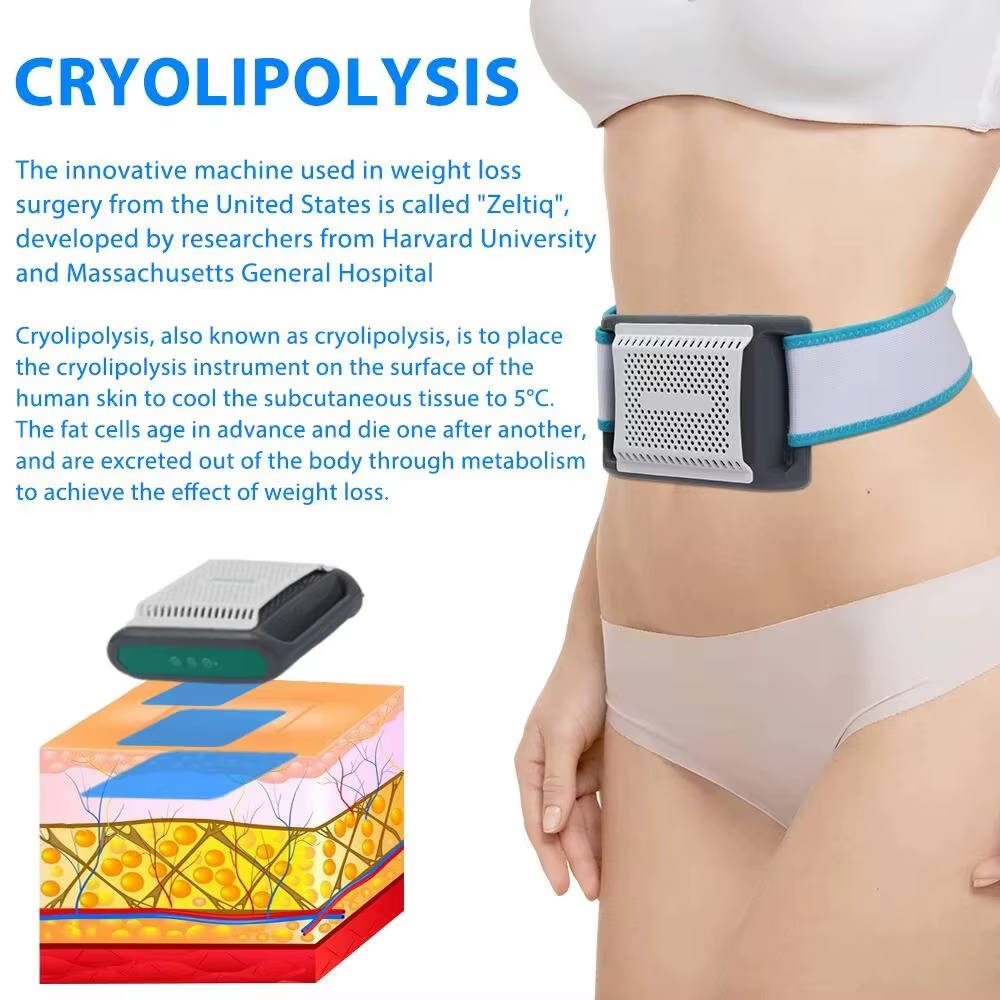 Cryothérapie pour dissoudre la graisse, thérapie par le froid, masseur anti-cellulite, machine de cryolipolyse abdominale, perte de graisse, amincissement du corps, cryolipolyse