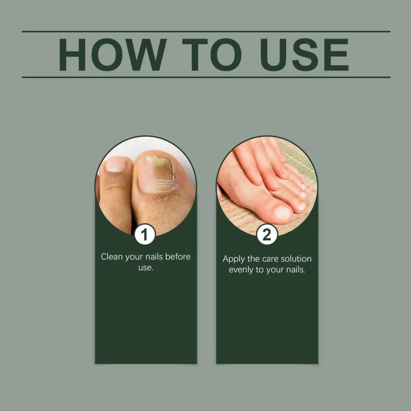 Liquide antifongique au gingembre et à l'arbre à thé pour les ongles abîmés, solution nourrissante et fortifiante pour les cuticules