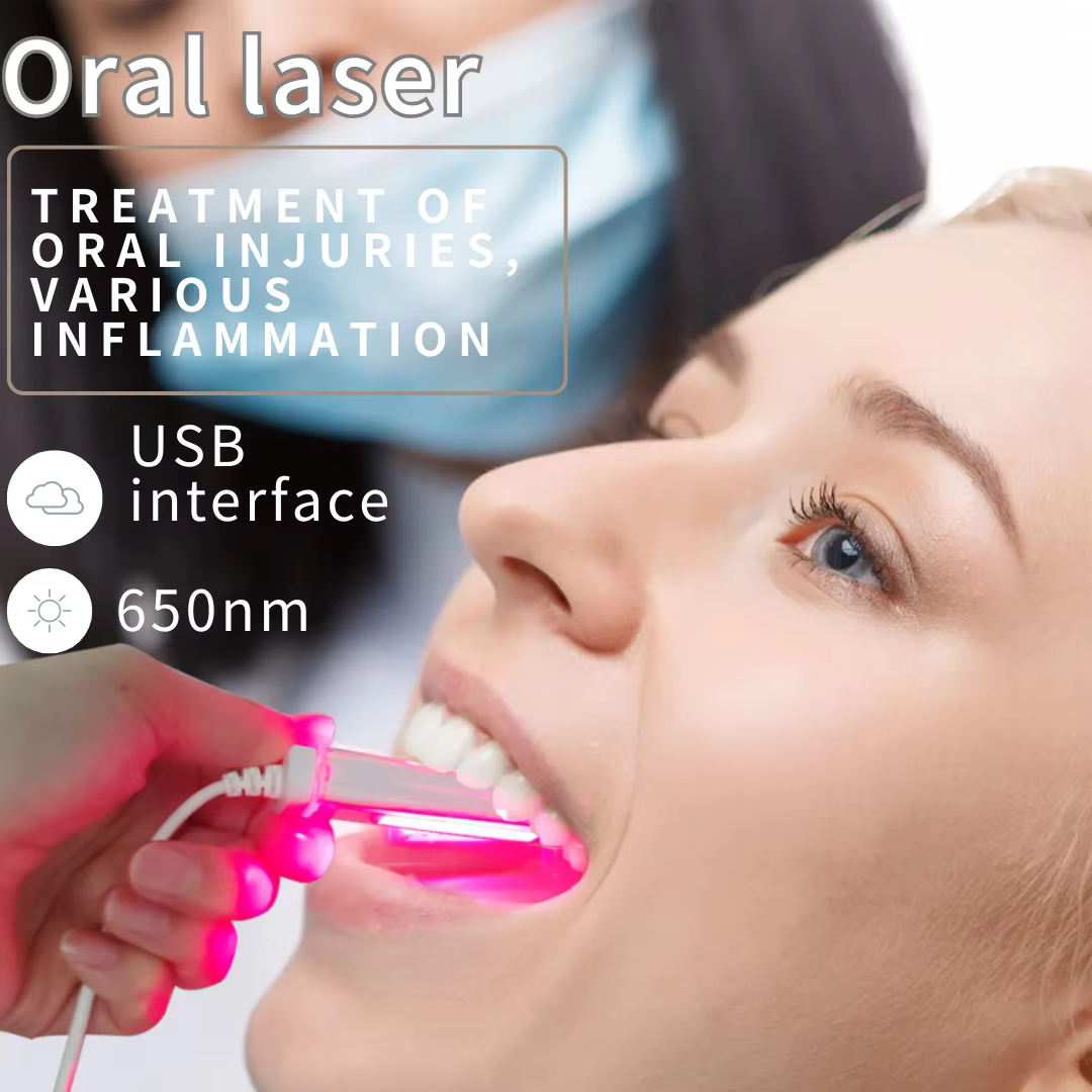 Traitement au laser pour les maladies parodontales - Parodontite et gingivite - Fournitures dentaires